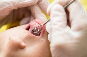 логопед дитячий