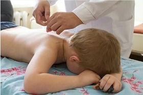 рефлексотерапія